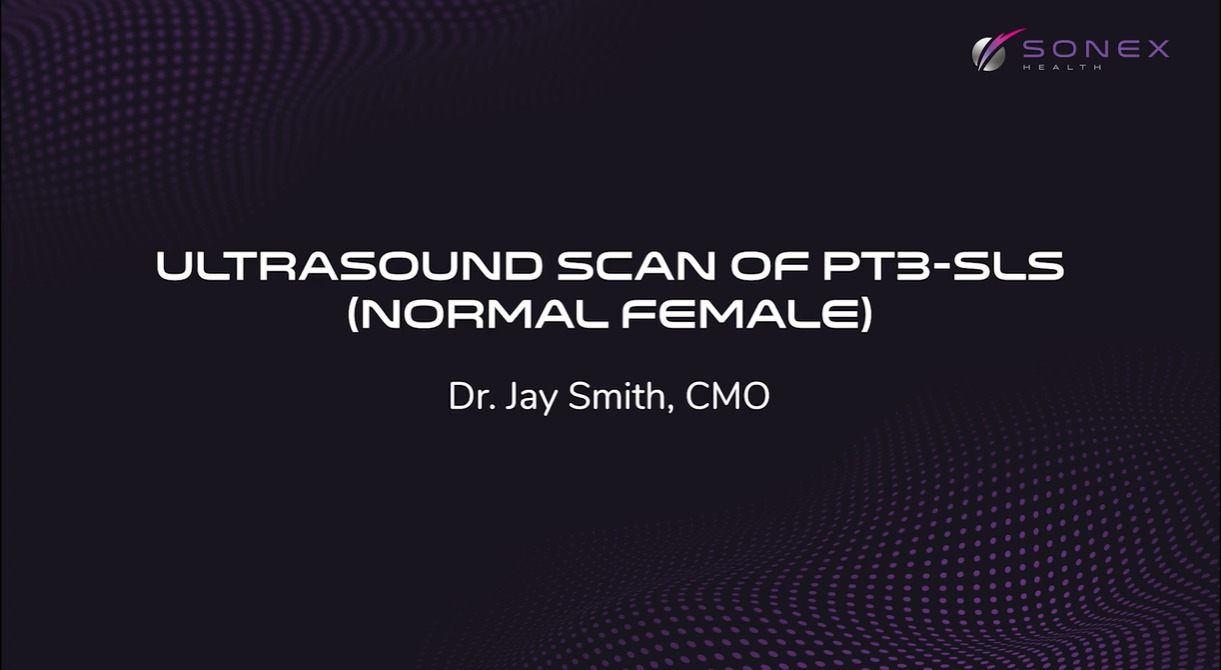 Ultrasound Scan of Carpal Tunnel - Female Patient