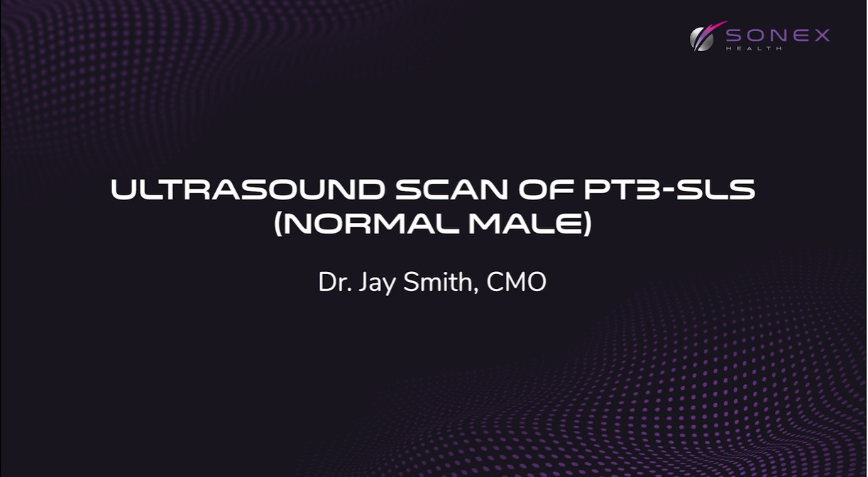 Ultrasound Scan of Carpal Tunnel - Male Patient