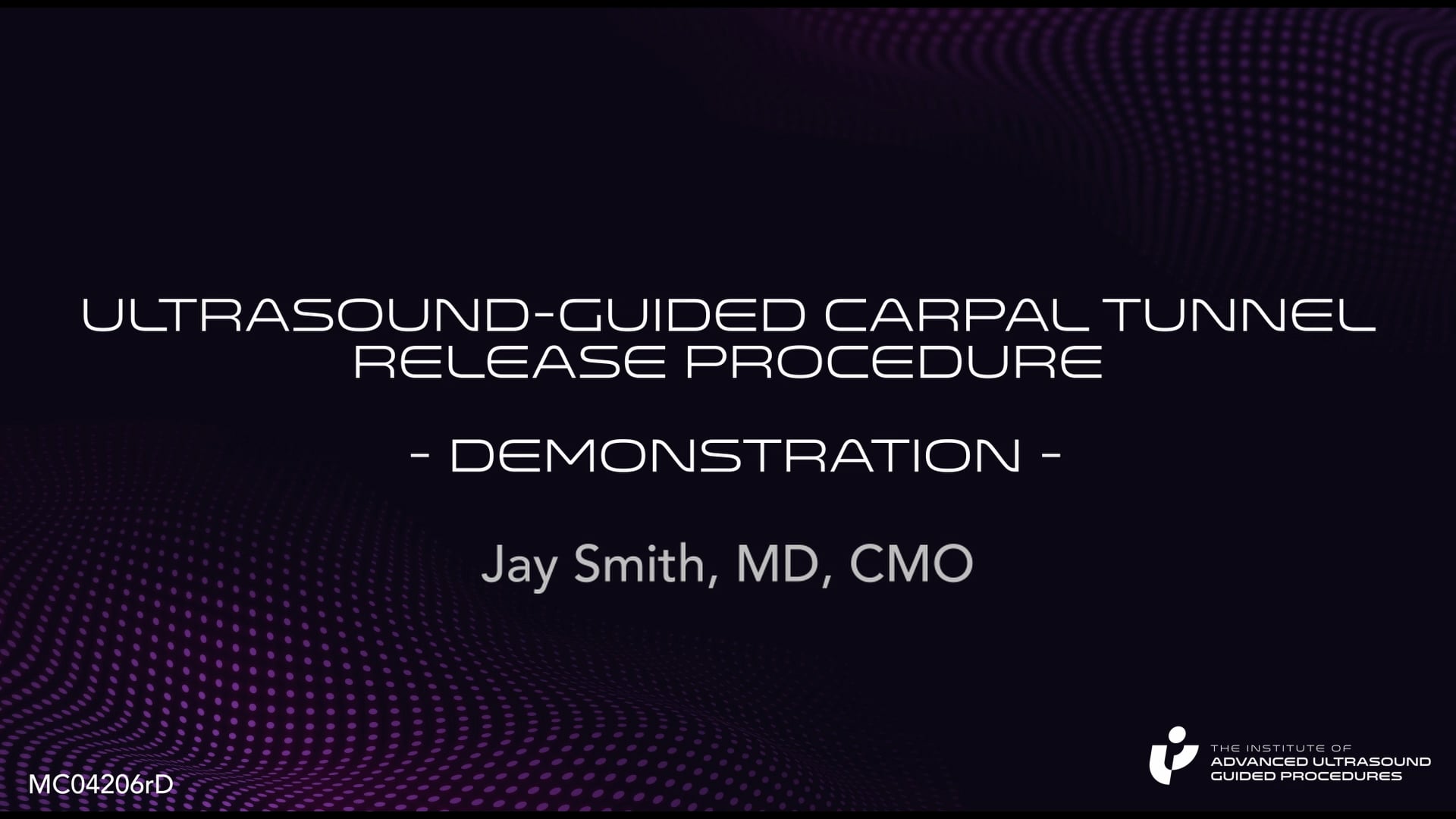 Ultrasound-Guided Carpal Tunnel Release Procedure