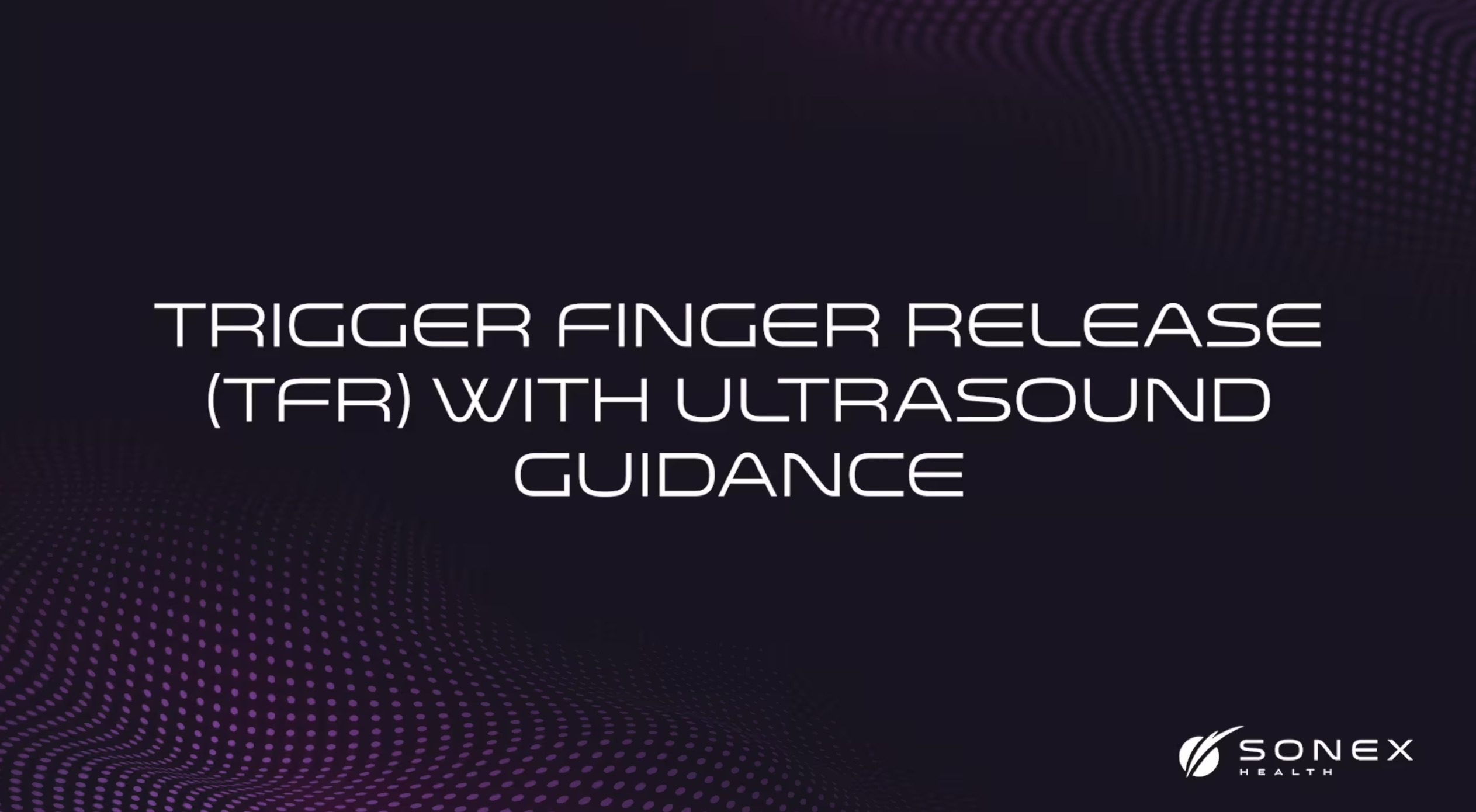 Trigger Finger Release (TFR) with Ultrasound Guidance