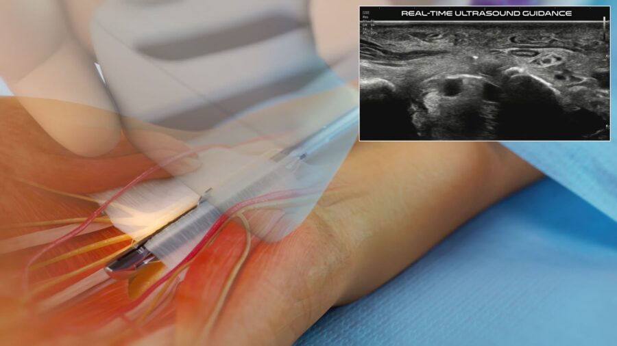 critical anatomy ultrasound of the wrist and hand