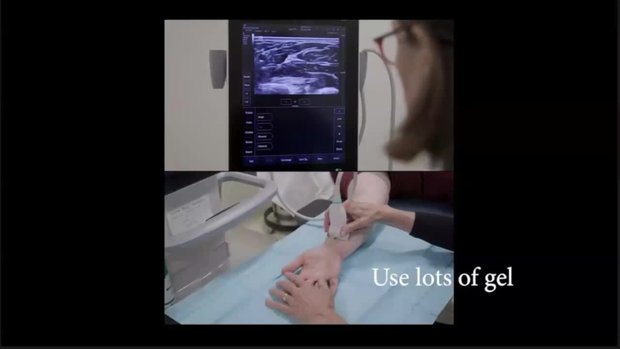 Integrating Ultrasound Into Your Practice - Vumedi
